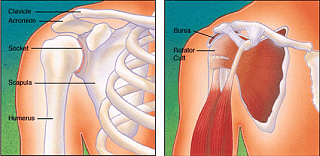 Torn Rotator Cuff = Painful Shoulder